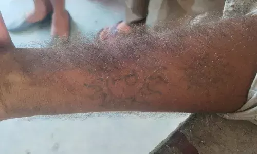 देर रात अज्ञात वाहन ने युवक को कुचला, मौके पर मौत, नहीं हुई शव की पहचान