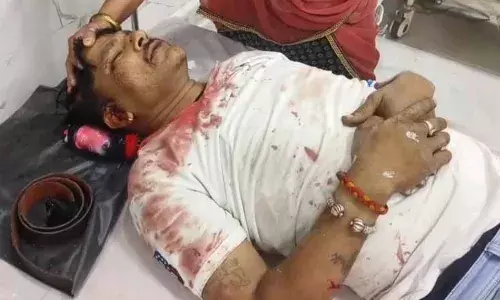 शारदा चौराहा पर जानलेवा हमला, युवक के दोनों पैर तोड़े