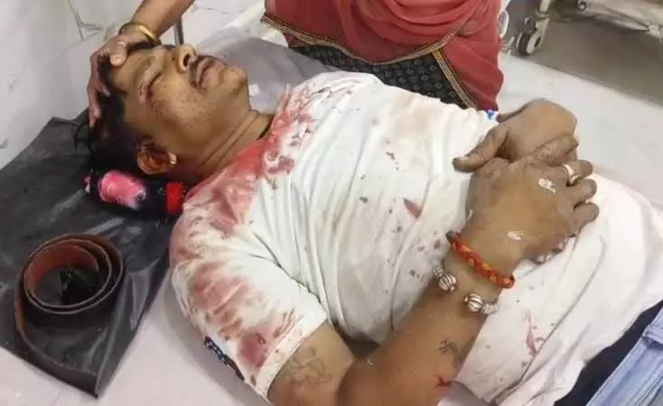 शारदा चौराहा पर जानलेवा हमला, युवक के दोनों पैर तोड़े