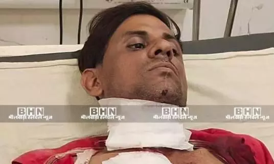 परिवारिक विवाद निपटाने निकले युवकों पर रास्ते में हमला, दो गंभीर घायल परिवारिक विवाद निपटाने निकले युवकों पर रास्ते में हमला, दो गंभीर घायल