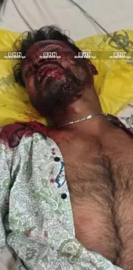 हाईवे पर लहू लुहान हालत में मिला युवक, हमला या हादसा, नहीं हुआ खुलासा हाईवे पर लहू लुहान हालत में मिला युवक, हमला या हादसा, नहीं हुआ खुलासा