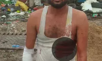 रायला में नॉनवेज होटल पर खाने को लेकर विवाद, युवक पर चाकू से हमला