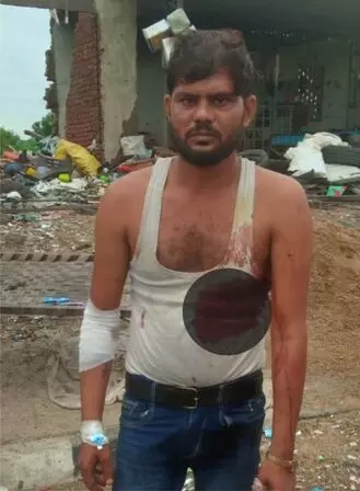 रायला में नॉनवेज होटल पर खाने को लेकर विवाद, युवक पर चाकू से हमला