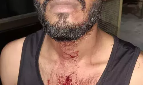 गुटका थूंकने को लेकर युवकों में विवाद, जुटी भीड़, गरमाया माहौल