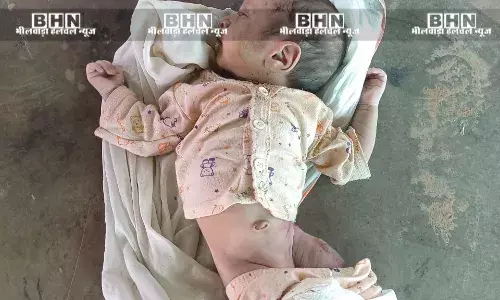 नवजात का मुंह फेवी क्विक से चिपका पत्थरों के नीचे दबाया , चरवाहों ने सुनी चीख तो बची नन्ही जान