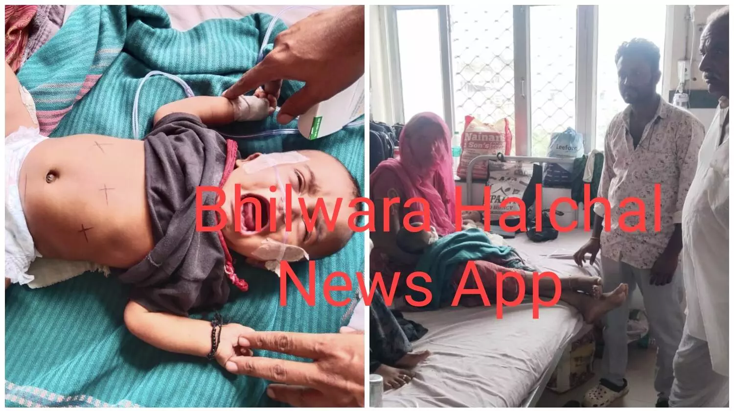 सांस की तकलीफ से जूझ रहे तीन माह के शिशु को पिता ने माताजी के नाम से लगाया डाम, हालत बिगड़ी सांस की तकलीफ से जूझ रहे तीन माह के शिशु को पिता ने माताजी के नाम से लगाया डाम, हालत बिगड़ी