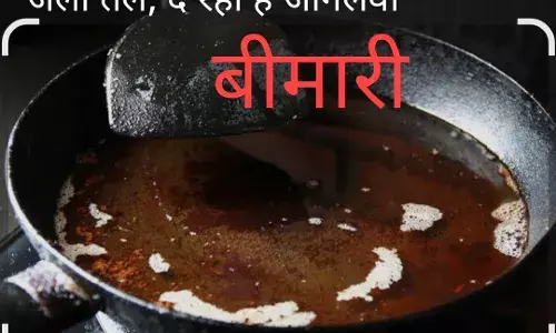 होटलों ,ठेलों पर परोसा जा रहा जहर, बार-बार गर्म तेल से बढ़ रहा कैंसर और हार्ट अटैक का खतरा होटलों ,ठेलों पर परोसा जा रहा जहर, बार-बार गर्म तेल से बढ़ रहा कैंसर और हार्ट अटैक का खतरा