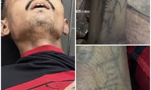 अंबाजी टैक्सटाइल मार्केट के सामने मिली युवक की लाश, नहीं हुई पहचान