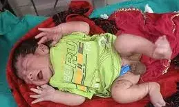 1 दिन के नवजात को डस्टबिन में फेंका, महिला ने रोने की आवाज सुनकर बचाई जान