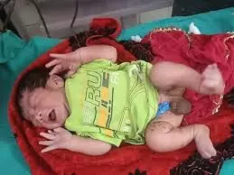 1 दिन के नवजात को डस्टबिन में फेंका, महिला ने रोने की आवाज सुनकर बचाई जान