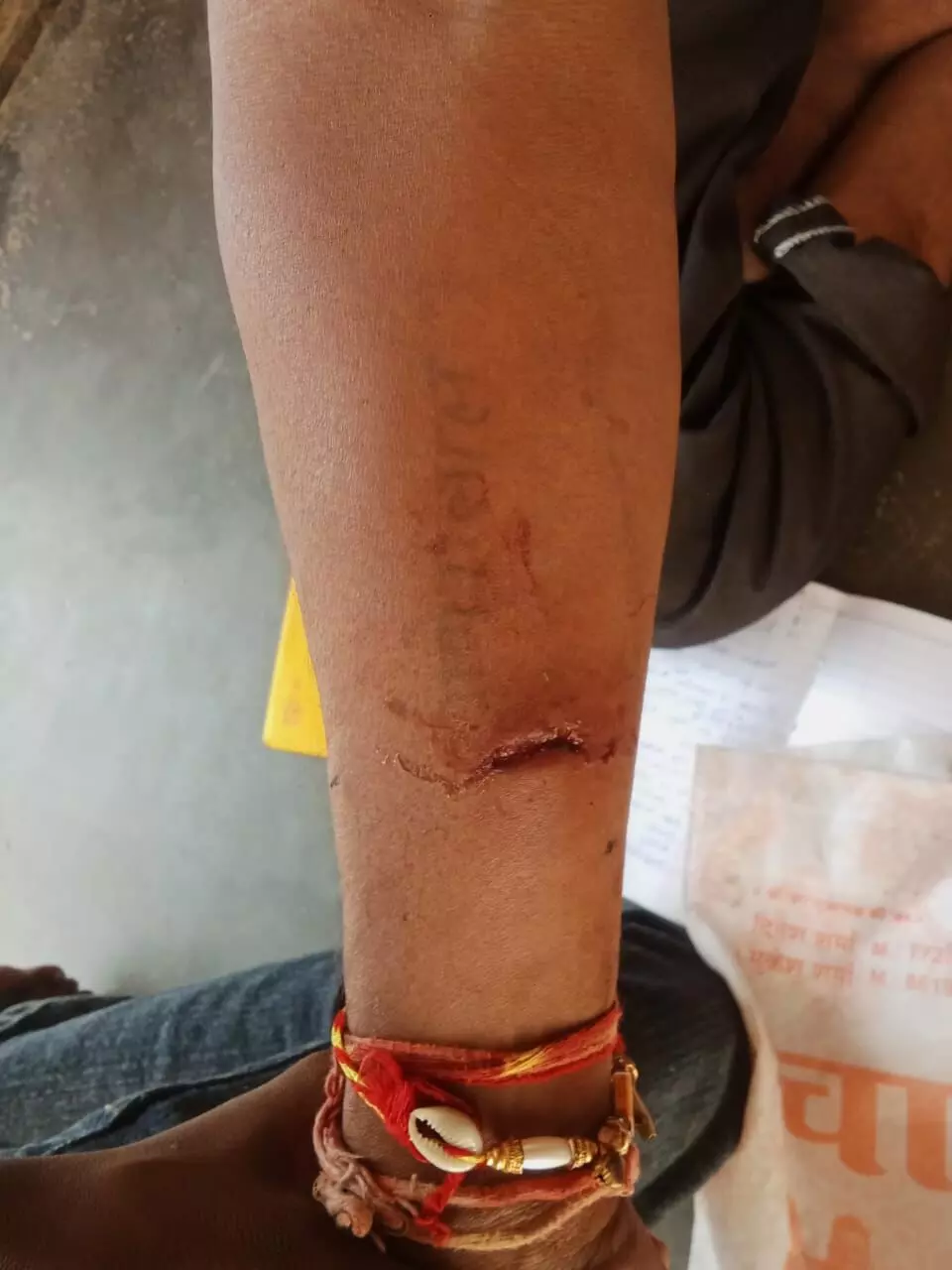 मालासेरी गांव में आक्रामक बंदर का आतंक, कई लोग घायल, लोग हदशत में मालासेरी गांव में आक्रामक बंदर का आतंक, कई लोग घायल, लोग हदशत में