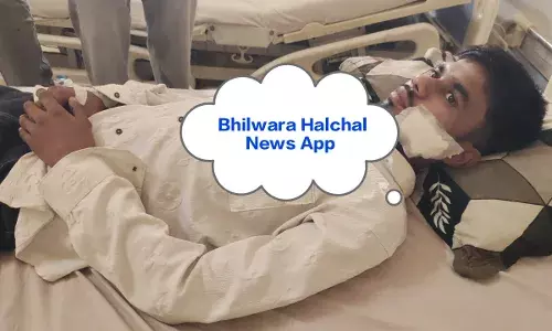 मौलाना को पहनाने माला मांगी तो गुस्साये लोगों ने दो भाइयों पर छुर्रे से किया हमला, दोनों घायल, केस दर्ज मौलाना को पहनाने माला मांगी तो गुस्साये लोगों ने दो भाइयों पर छुर्रे से किया हमला, दोनों घायल, केस दर्ज