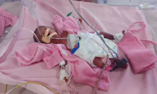 जीवन और मौत के बीच झूलती 600 ग्राम की जिंदगी,महात्मा गांधी अस्पताल में लावारिस छोड़ी गई नवजात जीवन और मौत के बीच झूलती 600 ग्राम की जिंदगी,महात्मा गांधी अस्पताल में लावारिस छोड़ी गई नवजात