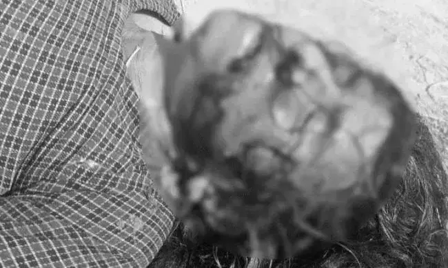 रुपए नहीं देने पर बेटे ने मां का किया मर्डर:लाठी-डंडों से पीटकर की हत्या