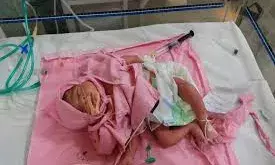 पालना घर में छोड़ी गई 600 ग्राम की कमजोर नवजात बालिका ने तोड़ा दम