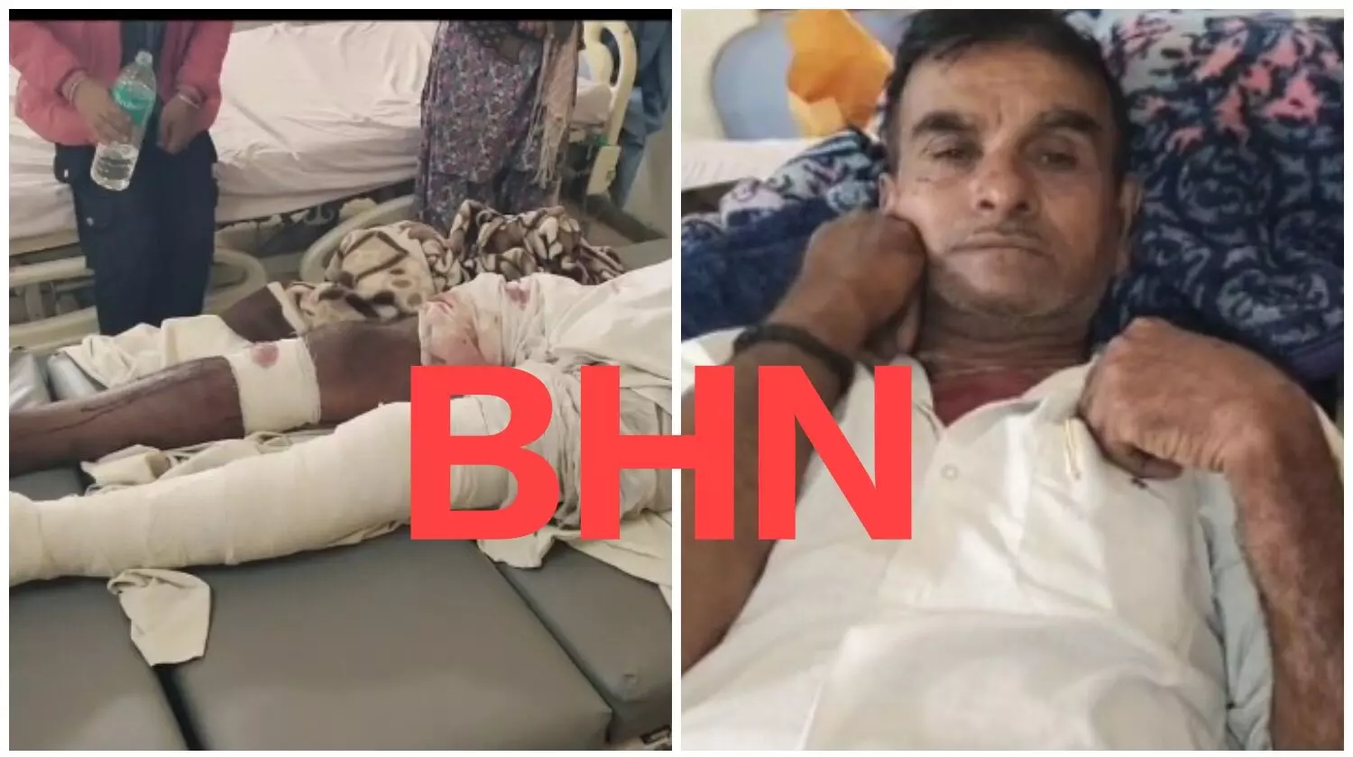 बैलगाड़ी आगे लगाकर बाप-बेटी को रोका, पाइप व कुल्हाड़ी से किया हमला, पूर्व सरपंच सहित दो दर्जन लोगों पर आरोप