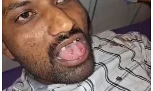 खेत में फसल को पानी दे रहे युवक के साथ मारपीट कर की फायरिंग , मुंह को छूती हुई निकली गोली