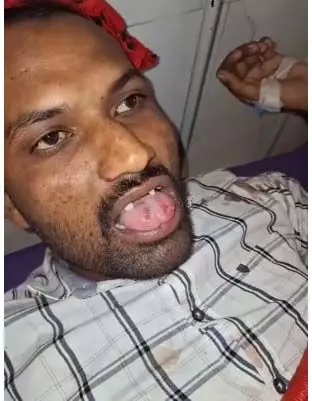 खेत में फसल को पानी दे रहे युवक के साथ मारपीट कर की फायरिंग , मुंह को छूती हुई निकली गोली