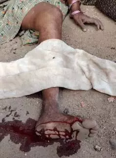 बंदरों के हमले से महिला गंभीर रूप से घायल, गांव में दहशत