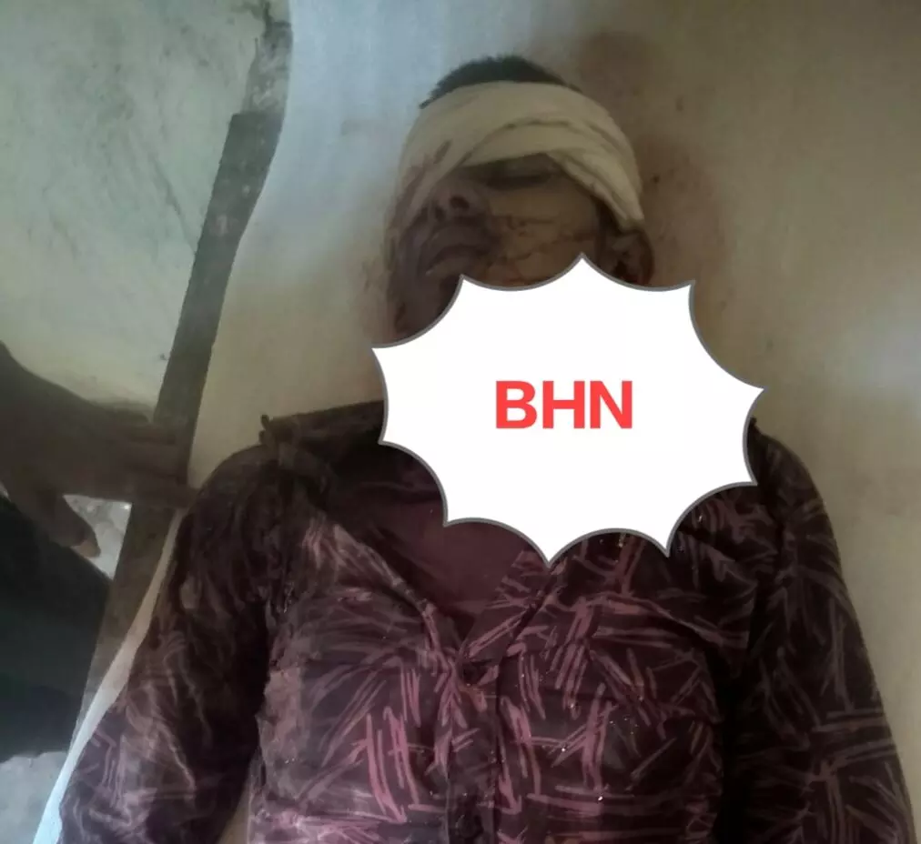 ब्लॉक कटर मशीन की प्लेट सिर पर गिरी, युवक की मौत, मची अफरा-तफरी