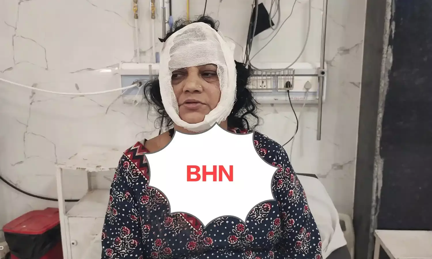 गाउन पहनकर घर में घुसे बदमाश ने महिला पर संडासी से किया हमला, गला दबाकर की मारने की कोशिश, लॉकर नहीं टूटा तो भाग छूटा