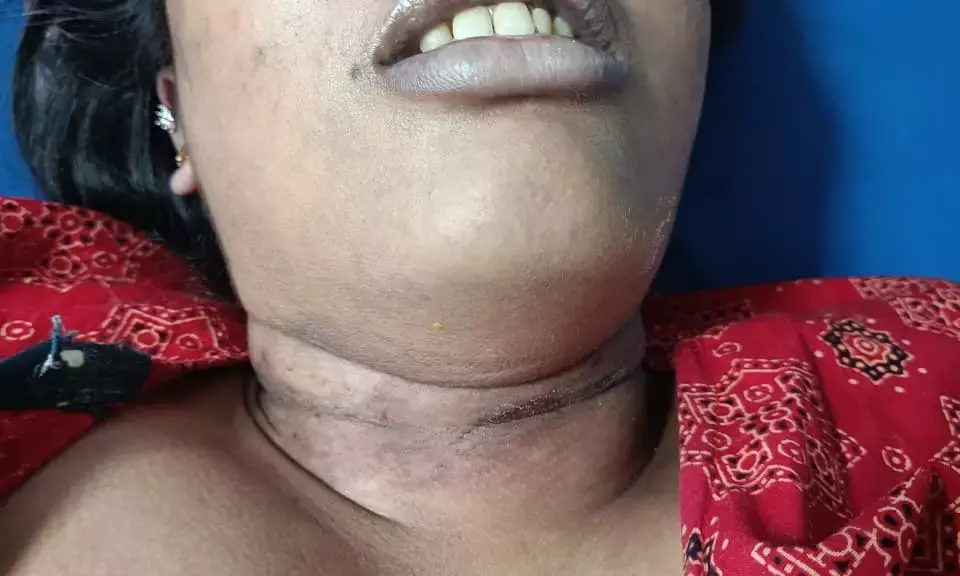 वेटरनरी छात्रा ने फांसी लगाकर की आत्महत्या, पारिवारिक तनाव वजह