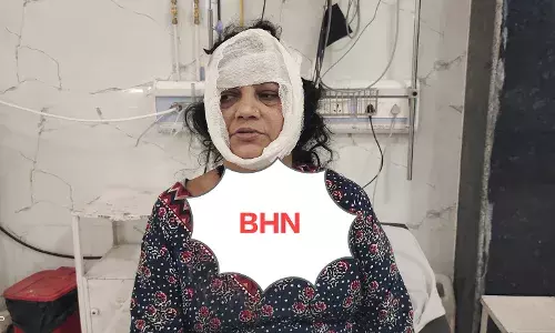 गाउन पहनकर घर में घुसे बदमाश ने महिला पर संडासी से किया हमला, गला दबाकर की मारने की कोशिश, लॉकर नहीं टूटा तो भाग छूटा