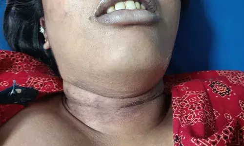 वेटरनरी छात्रा ने फांसी लगाकर की आत्महत्या, पारिवारिक तनाव वजह