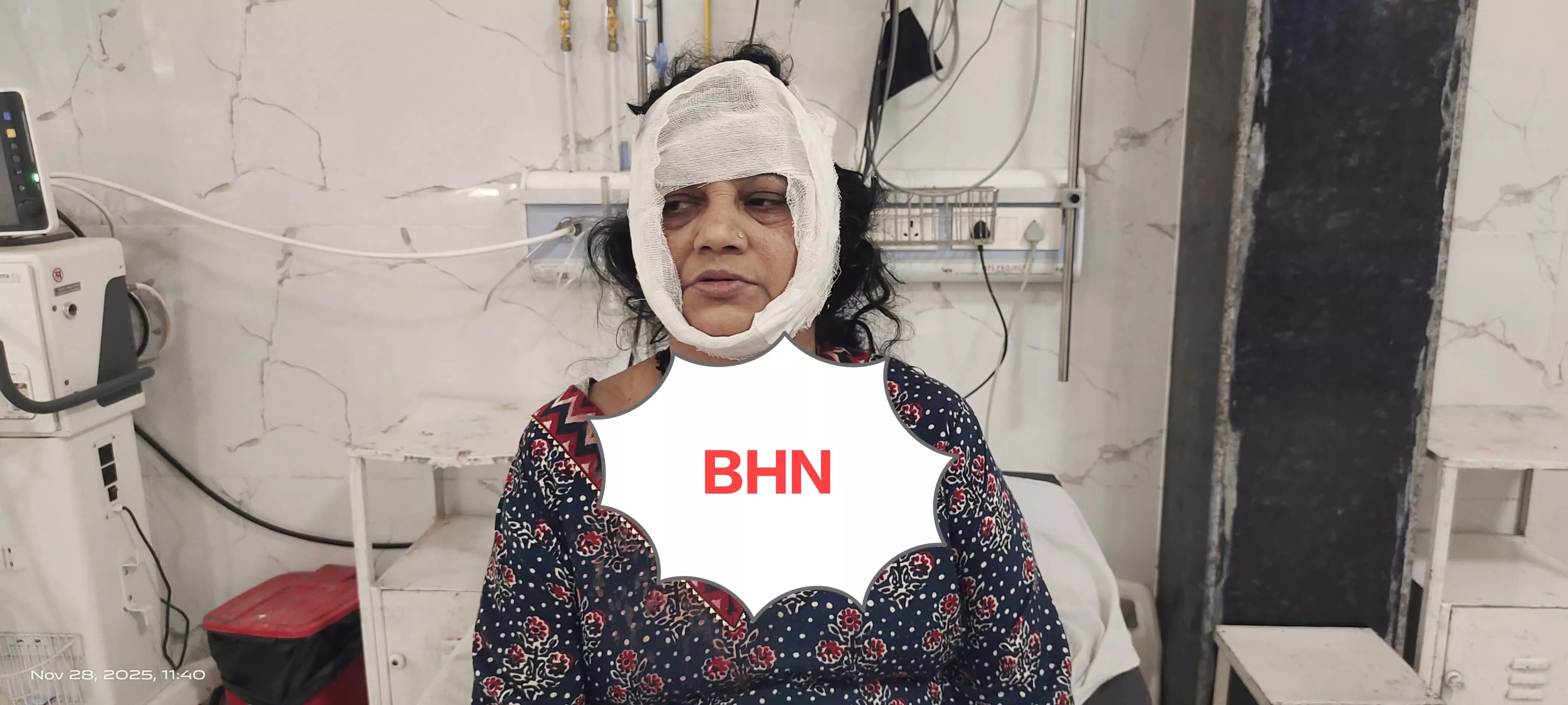 गाउन पहनकर घर में घुसे बदमाश ने महिला पर संडासी से किया हमला, गला दबाकर की मारने की कोशिश, लॉकर नहीं टूटा तो भाग छूटा