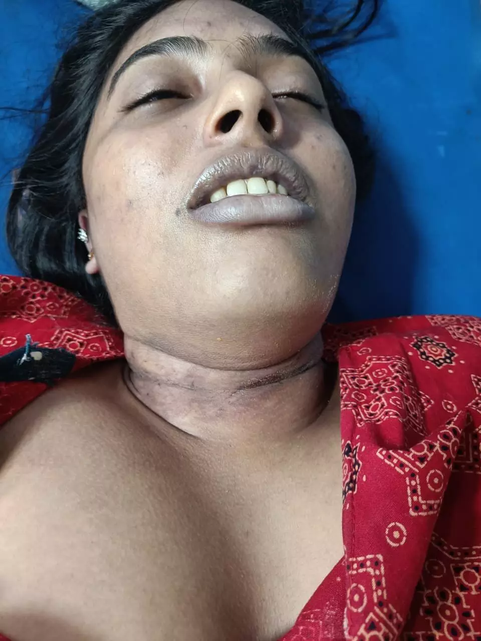 वेटरनरी छात्रा ने फांसी लगाकर की आत्महत्या, पारिवारिक तनाव वजह