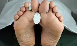 बाइक खड़े डंपर से भिड़ी, चालक की मौत, इंजिन चालू करते कुएं में गिरने से किसान की गई जान