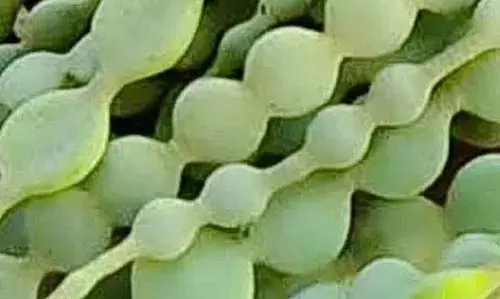 क्या आप अपने घुटनों के ऑपरेशन से बचना चाहते हैं?