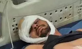 रायला के बाद अब बिजयनगर में फायरिंग, पुलिस गाड़ी के ड्राइवर को मारी गोली