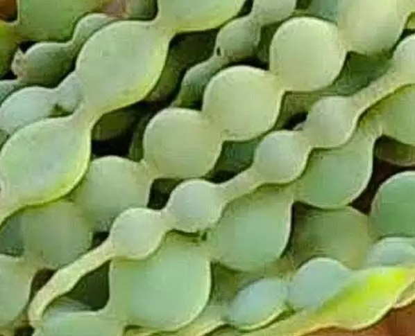 क्या आप अपने घुटनों के ऑपरेशन से बचना चाहते हैं? क्या आप अपने घुटनों के ऑपरेशन से बचना चाहते हैं?