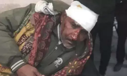 आसींद में नेशनल हाईवे पर दो बाइक की आमने-सामने टक्कर, 4 घायल आसींद में नेशनल हाईवे पर दो बाइक की आमने-सामने टक्कर, 4 घायल