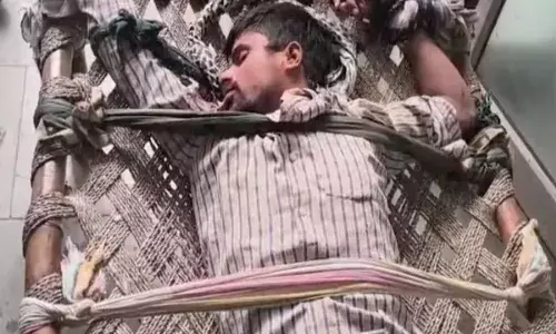 कुत्ते के काटने के बाद युवक की हालत बिगड़ी, करने लगा कुत्ते जैसी हरकत कुत्ते के काटने के बाद युवक की हालत बिगड़ी, करने लगा कुत्ते जैसी हरकत