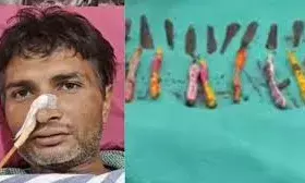 जयपुर में युवक के पेट से निकाले गए लोहे के पाने और टूथब्रश डॉक्टर भी रह गए हैरान जयपुर में युवक के पेट से निकाले गए लोहे के पाने और टूथब्रश डॉक्टर भी रह गए हैरान