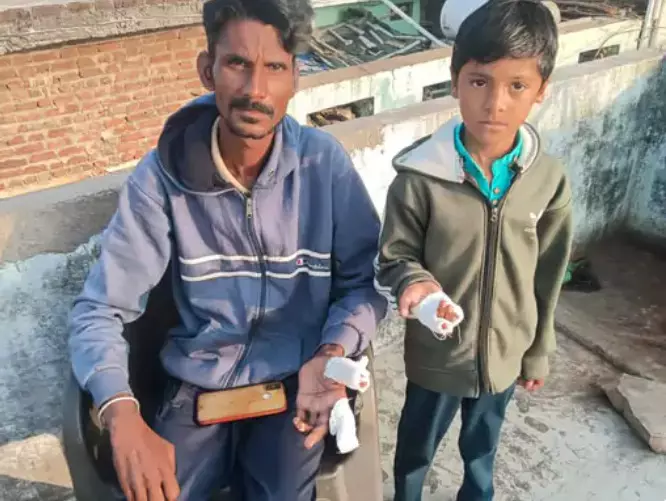 बिजौलिया में चाइनीज मांझे से युवक और बच्चे की उंगलियां कटी, प्रशासन पर उठे सवाल बिजौलिया में चाइनीज मांझे से युवक और बच्चे की उंगलियां कटी, प्रशासन पर उठे सवाल