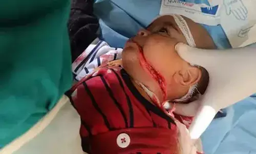 पतंग-लूटते समय पानी के टैंक में गिरे बच्चे की मौत,चाइनीज मांझे से 7 महीने के बच्चे का गला कटा