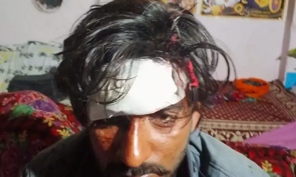 होटल पर खाना खाने गए युवक पर किया हमला , पूरी वारदात सीसीटीवी कैमरे में हुई कैद युवक ने पुलिस से लगाई गुहार