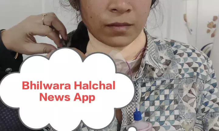 भीलवाड़ा में महिला की गर्दन कटी, दस टांकों के बाद बची जान