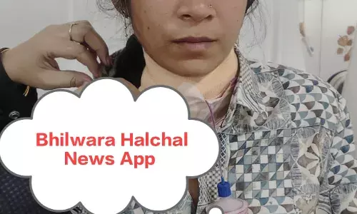 भीलवाड़ा में महिला की गर्दन कटी, दस टांकों के बाद बची जान