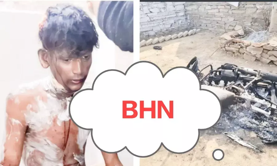 मंडोल बांध में पेट्रोल डालकर युवक को जलाया, बाइक भी फूंकी, फैली दहशत,एक आरोपित डिटेन मंडोल बांध में पेट्रोल डालकर युवक को जलाया, बाइक भी फूंकी, फैली दहशत,एक आरोपित डिटेन