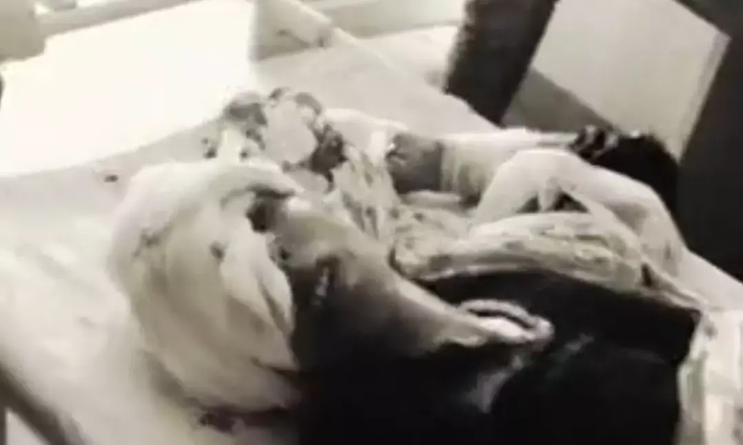 सिलाई दुकान में घुसकर महिला पर चाकू से ताबड़तोड़ वार; खून से लथपथ पीड़िता चीखती रही, मदद की बजाय तमाशबीन बने लोग