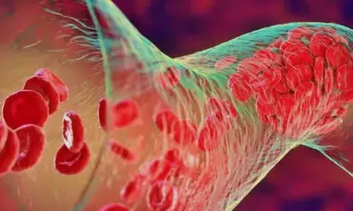 थैलेसीमिया और हीमोफिलिया मरीजों के लिए नए नियम: आयुष्मान योजना का लाभ चाहिए, तो अस्पताल में रहना होगा इतने घंटे भर्ती