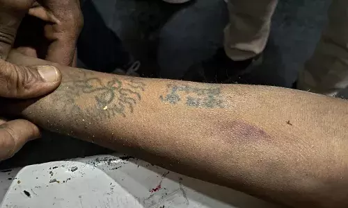 शास्त्रीनगर में सडक़ हादसा-अज्ञात युवक की मौत, हाथ पर गुदा है दिनेश  -