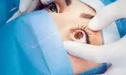 निःशुल्क नेत्र जांच एवं मोतियाबिंद ऑपरेशन शिविर 23 फरवरी को