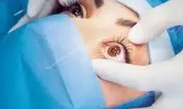 निशुल्क नेत्र जांच एवं लैंस प्रत्यारोपण शिविर  २६ को