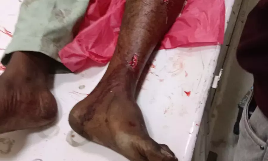 भीलवाड़ा: युवक पर खौफनाक हमला, हाथ-पैर तोड़े; अधमरा कर घर के बाहर फेंका, पूरे परिवार को बंदूक से भूनने की धमकी!