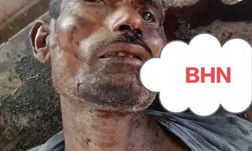 अज्ञात वाहन ने ली अधेड़ की जान, सड़क पर बिखरा मिला खून